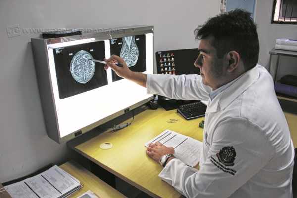 Uma marca histórica para o Ambulatório Médico de Especialidades (AME) de Rio Claro acaba de ser conquistada: a de 35 mil mamografias realizadas.