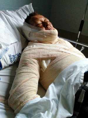 Silvana é conhecida na região do Parque São Jorge. Uma mulher teria ateado fogo a seu corpo