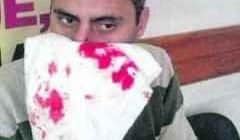 Professor foi agredido dentro da Escola Estadual "Prof. João Baptista Negrão"