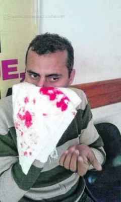 Professor foi agredido dentro da Escola Estadual "Prof. João Baptista Negrão"