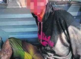 Polícia Civil prende um dos suspeitos acusados de balear aposentado