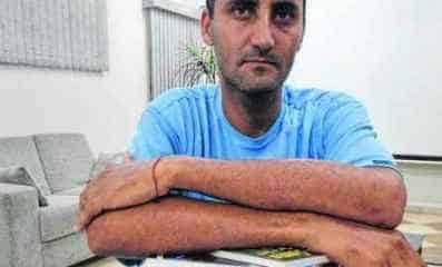 Walter Rocha e Silva teve o nariz quebrado ao ser atingido por uma tartaruga, equipamento de sinalização de trânsito. O objeto foi lançado por seu aluno, de 14 anos