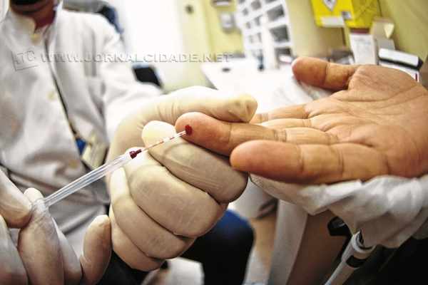 Unidades de saúde fazem testes rápidos para Aids (Foto Marcelo Camargo/Agência Brasil)