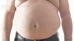 Obesos têm que esperar quase três anos na fila de espera por cirurgia de redução de estômago (foto: Divulgação)