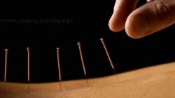 Método de terapia gerado da clássica medicina da China, a acupuntura é uma das práticas medicinais mais antigas de toda a história