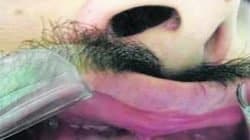 Mãe da vítima procurou o JC para relatar os momentos de agressão que o filho sofreu em uma casa noturna