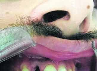 Mãe da vítima procurou o JC para relatar os momentos de agressão que o filho sofreu em uma casa noturna