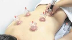 Técnica milenar chinesa é cada vez mais utilizada por atletas olímpicos; o médico Fabio Grilo explica os benefícios do tratamento