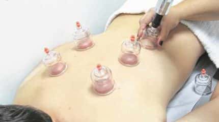 Técnica milenar chinesa é cada vez mais utilizada por atletas olímpicos; o médico Fabio Grilo explica os benefícios do tratamento