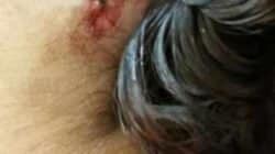 Vítima foi esfaqueada pelo marido no Jardim Novo. Ele chegou a perfurar os pulmões da mulher