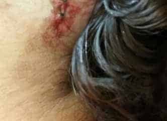 Vítima foi esfaqueada pelo marido no Jardim Novo. Ele chegou a perfurar os pulmões da mulher