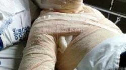 Silvana é conhecida na região do Parque São Jorge. Uma mulher teria ateado fogo a seu corpo