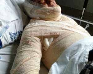 Silvana é conhecida na região do Parque São Jorge. Uma mulher teria ateado fogo a seu corpo