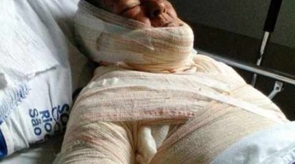 Silvana tinha deficiência mental e havia sido transferida para Santa Casa de Limeira (foto: arquivo)