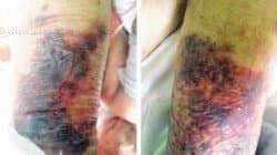 Após ser colocada em maca por profissionais da Saúde, idosa de 80 anos acabou caindo. Sindicância foi instaurada pela Fundação Municipal de Saúde