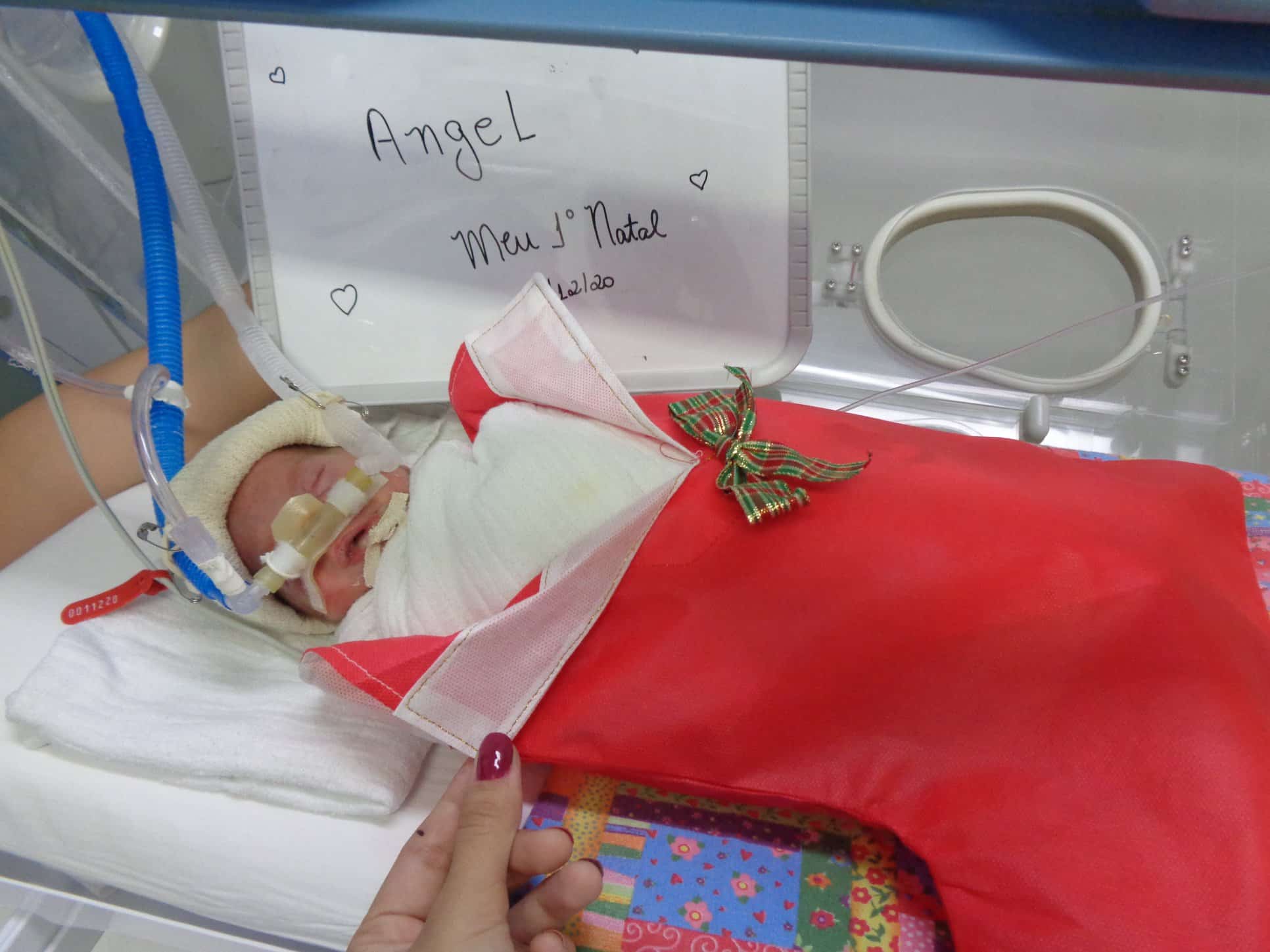 FOTOS bebês da UTI e berçário da Santa Casa de Rio Claro fazem ensaio natalino Jornal Cidade RC