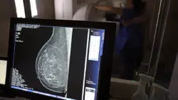 Mulheres com câncer de mama têm direito a apoio financeiro e previdenciário.