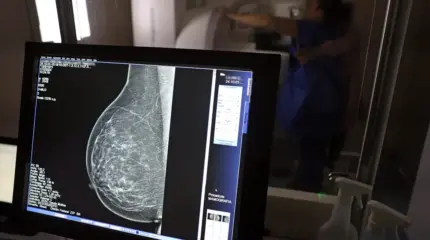 Mulheres com câncer de mama têm direito a apoio financeiro e previdenciário.